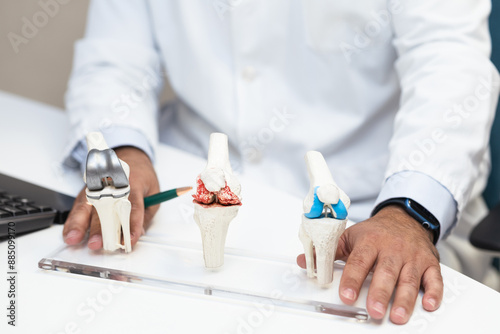 Orthopedic doctor explaining knee implants