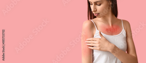 Young woman with red sunburned skin on pink background with space for text photo