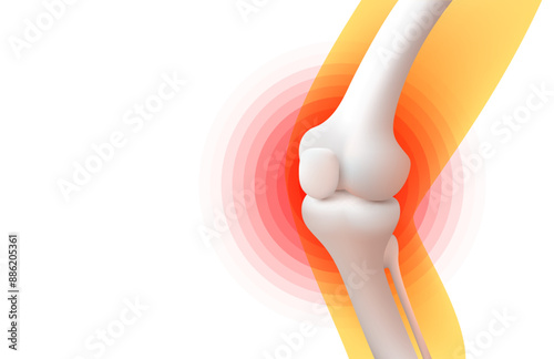 knee pain, X-ray of the leg, 3D visualization. Vector illustration
