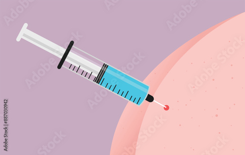Vaccine shot injection - Syringe needle injected and inserted on butt cheek skin in close up. Vaccination, medicine and immunisation concept illustration in cartoon flat design vector style