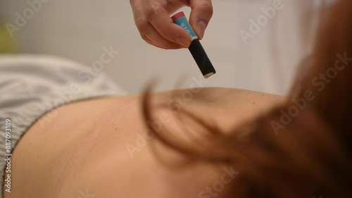 Closeup of moxa cigar held to back of female patient between acupuncture needles during healing and fertility moxibustion treatment. Healing, acupuncturist, massage therapy with physical therapy