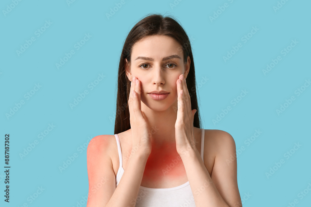 Allergic young woman with red sunburned skin on blue background Allergic young woman with red sunburned skin on blue background