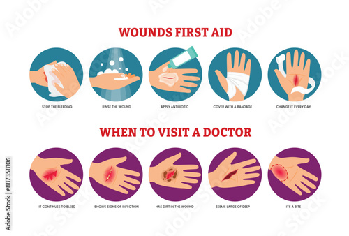 First aid for wound on skin. Treatment procedure for bleeding cut. Bandage on injured palm. Emergency situation safety infographic in vector. Illustration aid skin, injury and trauma