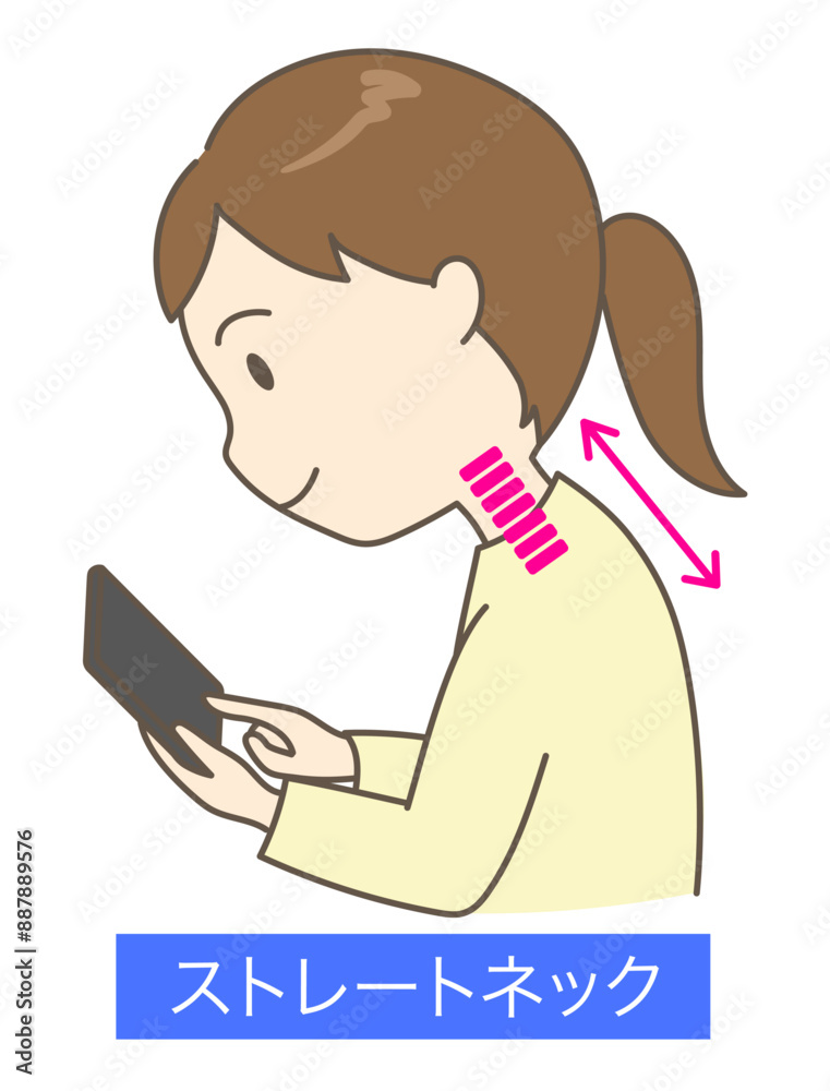 猫背でスマホを見ているストレートネックの若い女性2 猫背でスマホを見ているストレートネックの若い女性2