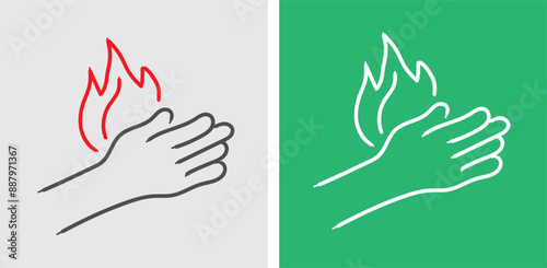 Common Causes of Burns Heat, Chemicals, Electricity, and Radiation