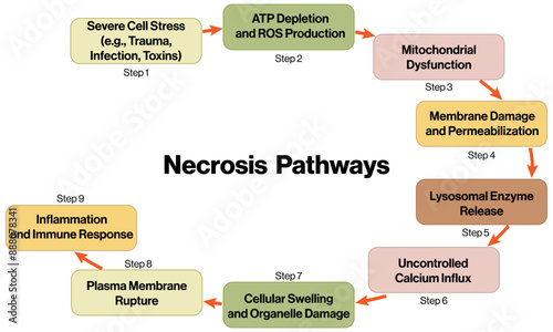 Detailed Flowchart of Necrosis Pathway, Scientific Vector Illustration on White Background.