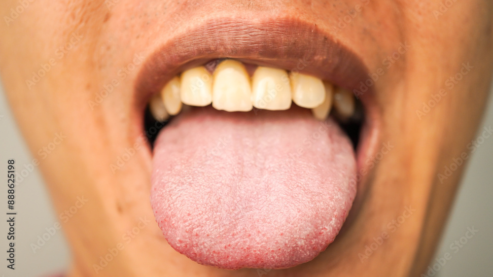 Obraz premium Close-up photo of a man sticking his tongue out, showing the detailed papillae on the tongue's surface. Concept for mouth and dental health
