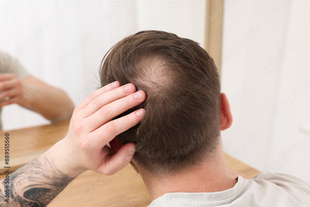 Baldness concept. Man with bald spot looking at mirror indoors, back view Baldness concept. Man with bald spot looking at mirror indoors, back view