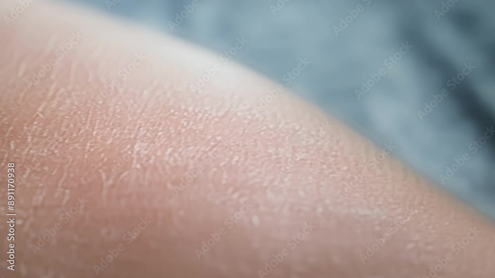 The skin recoiling and turning pale at the cold touch on the shoulder. The skin recoiling and turning pale at the cold touch on the shoulder.