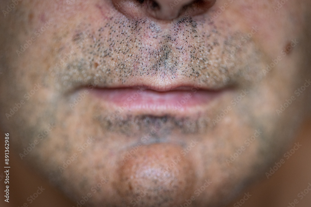 Close up shot of the mouth of mature male with spikes of facial hair around it Close up shot of the mouth of mature male with spikes of facial hair around it