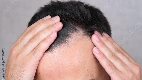 suffering hair loss