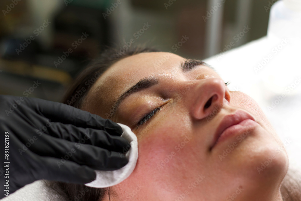 Fototapeta premium A beautician wearing black gloves cleanses a woman's face with a cotton pad after applying a skincare product. The image showcases the importance of post-treatment care.