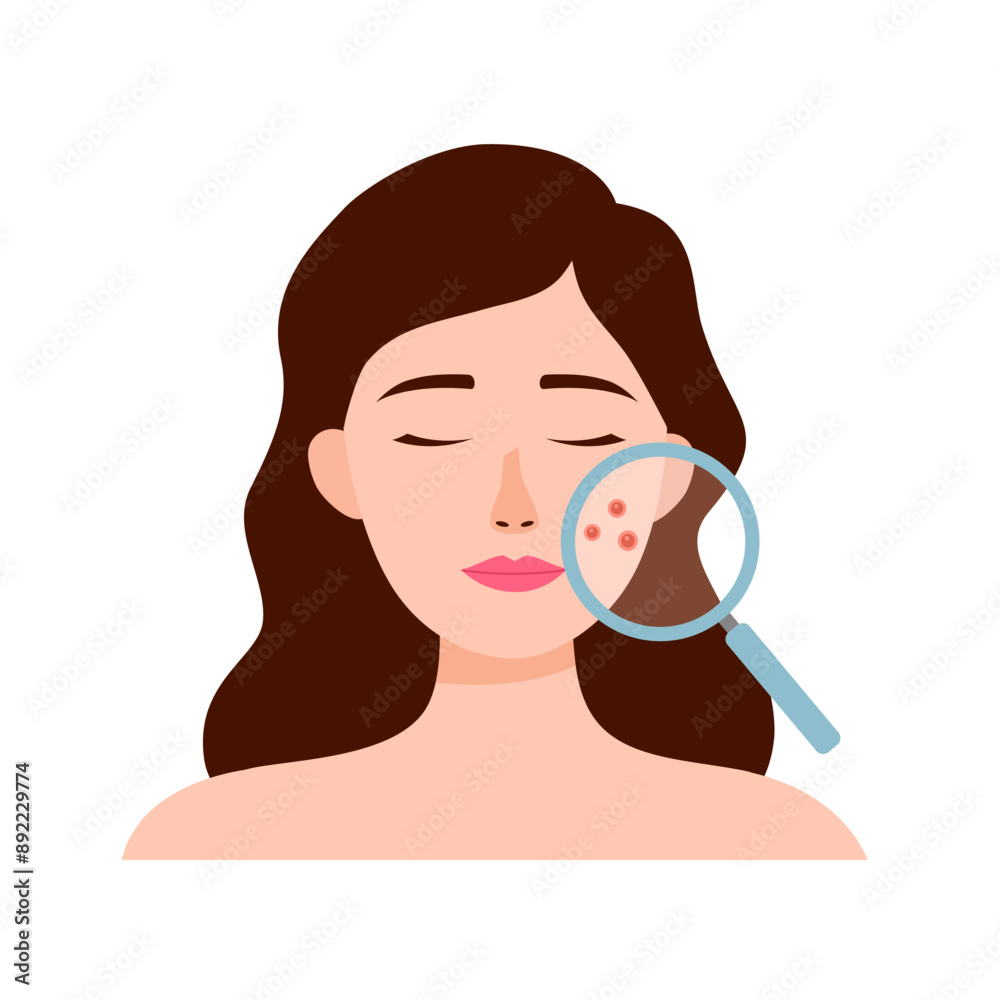 Acne skin problem concept. Woman face with magnifying glass and red pimples on skin. Acne skin problem concept. Woman face with magnifying glass and red pimples on skin.