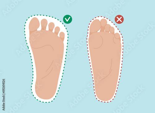 Healthy and deformed human feet comparison. Barefoot shoes concept