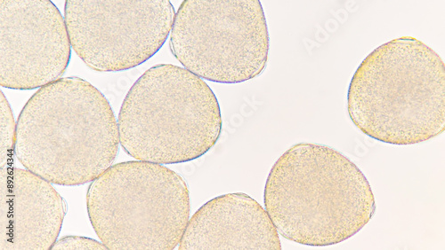 Melon (Cucumis melo) pollen grains under light microscope. Curcubitaceae pollen grains. 400x magnification + 2.8x camera zoom. Fresh sample. Selective focus image. photo