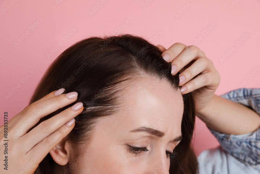 Woman with hair loss problem on pink background, closeup Woman with hair loss problem on pink background, closeup
