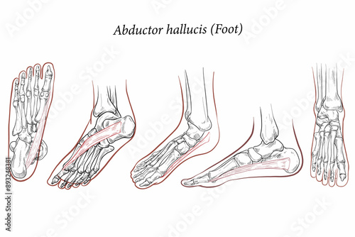 Medical illustration of Abductor Hallucis muscle foot, oblique side view of the foot. The metatarsal bones and muscles of the feet. Line drawings for medicine and sports science or education learning.