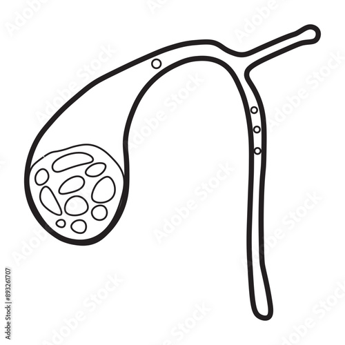 gallstones line icon 