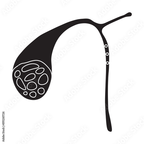 gallstones glyph icon 