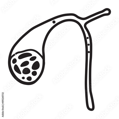 gallstones line icon 