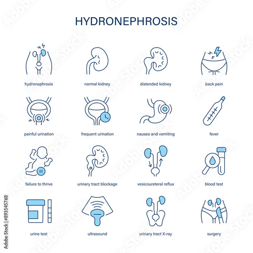 Hydronephrosis symptoms, diagnostic and treatment vector icons. Medical icons.