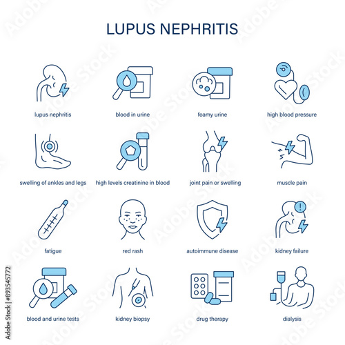 Lupus Nephritis symptoms, diagnostic and treatment vector icons. Medical icons.