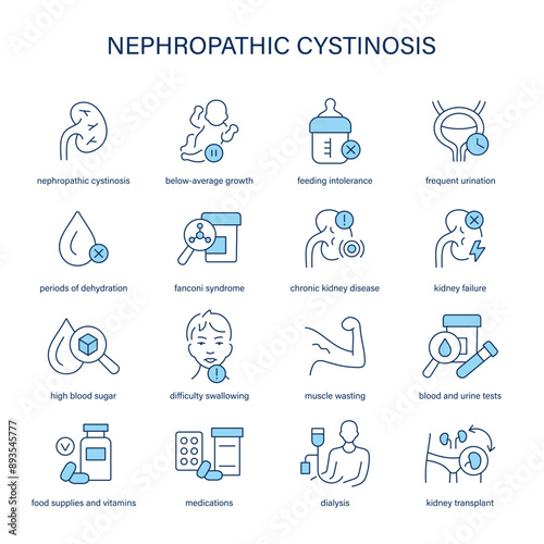 Nephropathic Cystinosis symptoms, diagnostic and treatment vector icons. Medical icons. photo