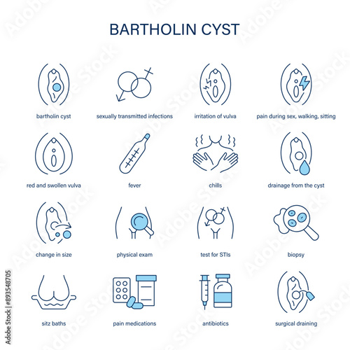 Bartholin Cyst symptoms, diagnostic and treatment vector icons. Medical icons.