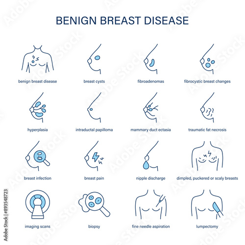 Benign Breast Disease symptoms, diagnostic and treatment vector icons. Medical icons.