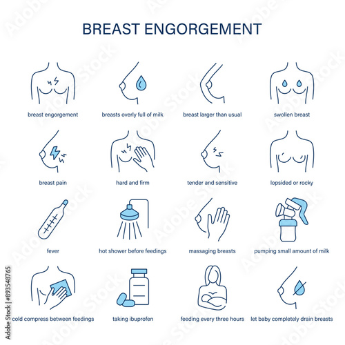 Breast Engorgement symptoms, diagnostic and treatment vector icons. Medical icons.