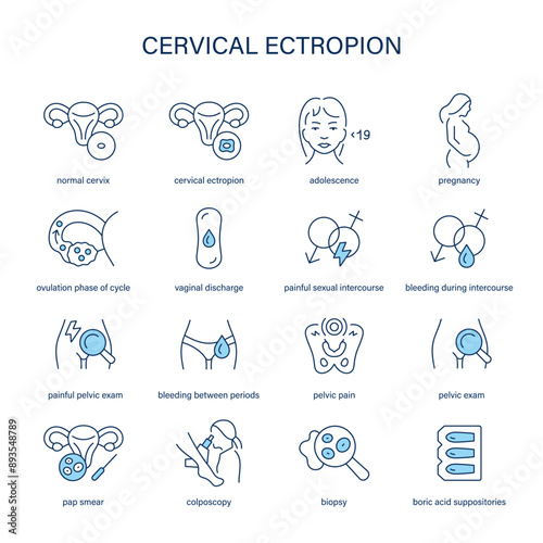 Cervical Ectropion symptoms, diagnostic and treatment vector icons. Medical icons.