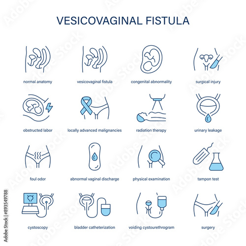 Vesicovaginal Fistula symptoms, diagnostic and treatment vector icons. Medical icons.