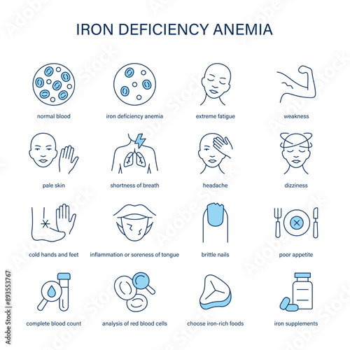 Iron Deficiency Anemia symptoms, diagnostic and treatment vector icons. Medical icons.