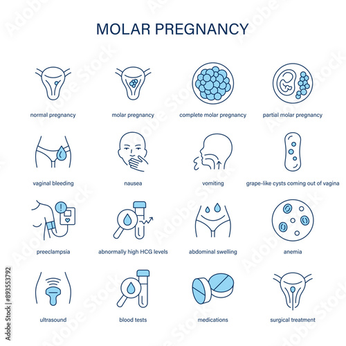 Molar Pregnancy symptoms, diagnostic and treatment vector icons. Medical icons.