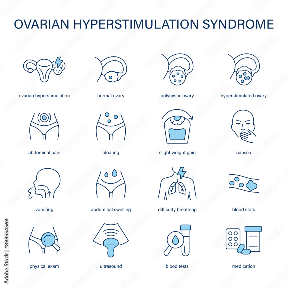 Ovarian Hyper Stimulation Syndrome symptoms, diagnostic and treatment vector icons. Medical icons. Ovarian Hyper Stimulation Syndrome symptoms, diagnostic and treatment vector icons. Medical icons.