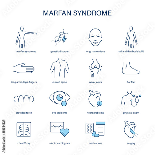Marfan Syndrome symptoms, diagnostic and treatment vector icons. Medical icons.