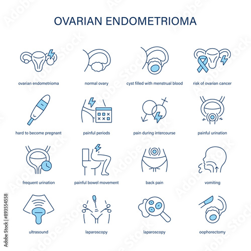 Ovarian Endometrioma symptoms, diagnostic and treatment vector icons. Medical icons.