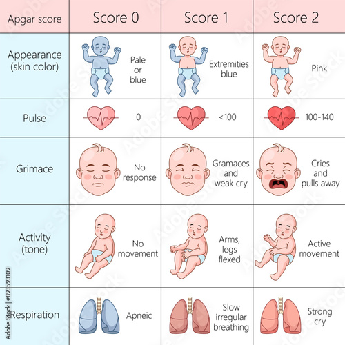 Apgar score chart evaluating the health of newborns, appearance, pulse, grimace, activity, and respiration diagram hand drawn schematic vector illustration. Medical science educational illustration