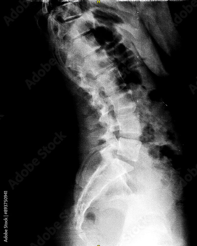 X-ray of lumbar spine and pelvis. Lateral view. Vertebrae and intervertebral joints of lower back and coccyx. Healthy backbone anatomy radiography image.