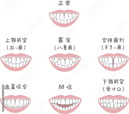 様々な歯並びの女性のイラストセット
