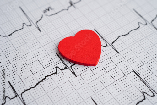 Electrocardiogram (ECG), heart wave, heart attack, cardiogram report. photo