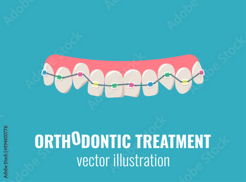 Colorful  braces on crooked teeth. Orthodontic treatment, dental care