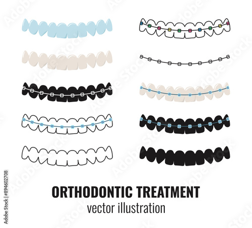 Set of dental illustrations with teeth, dental braces and aligners, teeth silhouette. Orthodontic treatment, dental care