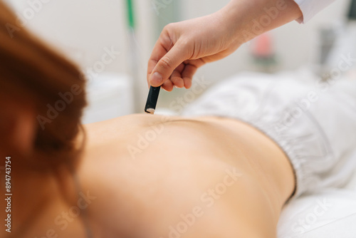 Wallpaper Mural Closeup cropped shot of moxibustion treatment with smoke from moxa stick. Female client lying on spa bed during moxa smoke therapy. Spiritual healing, body and stress relief with Chinese treatment. Torontodigital.ca