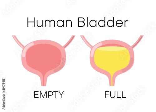 Human bladder anatomy. Empty and full urinary bladder. Vector illustration isolated on white background.