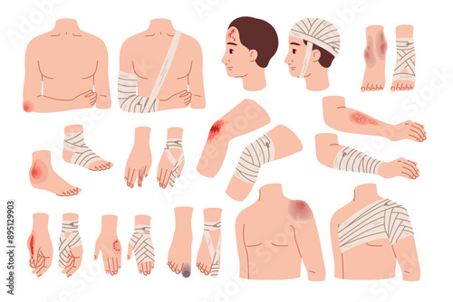 Applying bandages to wounds. Fixation and isolation of bruises. Bone fractures. Affected body parts. Physical injury. Emergency help. Hospital treatment. Plaster at knee. Recent vector set