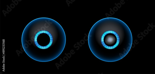 Cataract eye disease