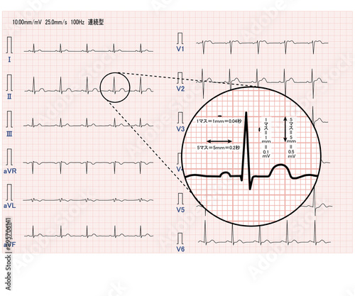 十二誘導心電図 標準感度 photo