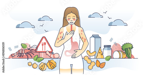 Allergic reaction from food ingredients and grocery products outline concept, transparent background. Nuts, almonds, dairy or seafood as dangerous cause for itchy skin, rash.