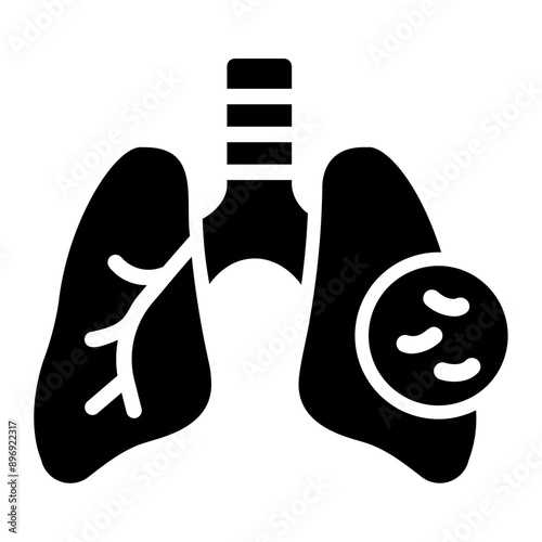 tuberculosis